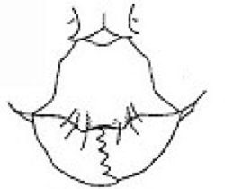 {Camponotus emarginatus}