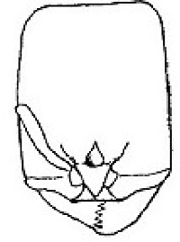 {Oligomyrmex hewitti soldier face}